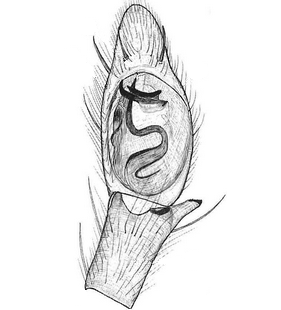 species