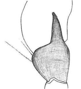 species