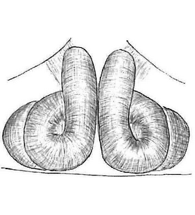 species