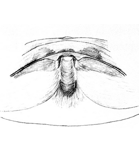 species