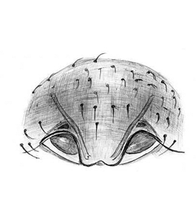 species
