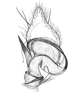 species