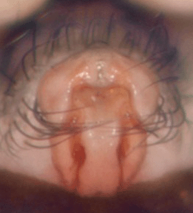 speciesimage
