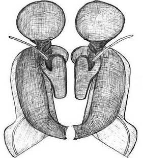 species