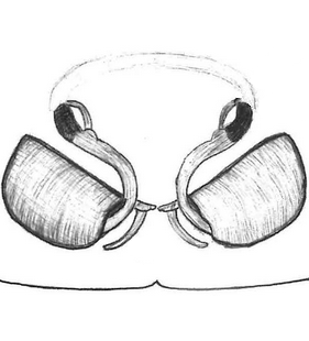 species