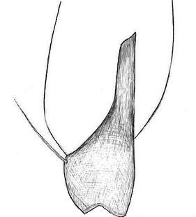 species