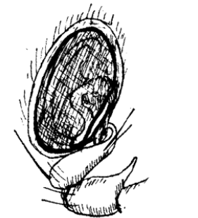 species