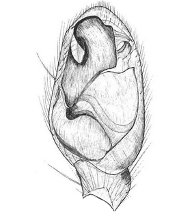 species