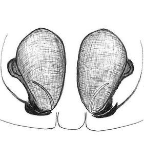 species